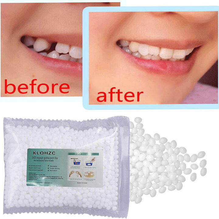 50g Denture Adhesive Glue Temporary Tooth Repair Kit Moldable False