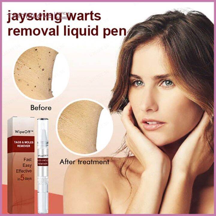 Tattielove Jaysuing Liquid Warts Flat Eliminate Wart Pen Liquid Hand