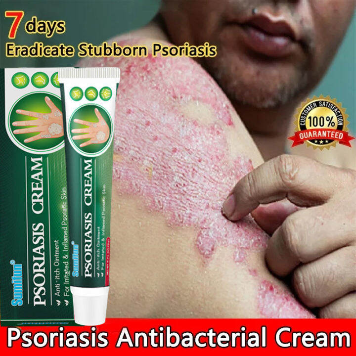 Original And Authentic Atoderma Cream Eczema Treatment Cream