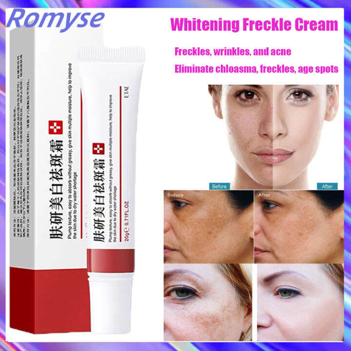 Romyse Whitening Freckle Cream Remove Dark Spots Anti Freckle Cream