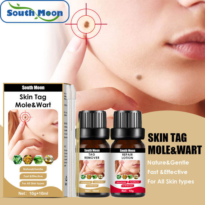 South Moon Skin Tag Remover Original Set Painless Tags Moles Remover