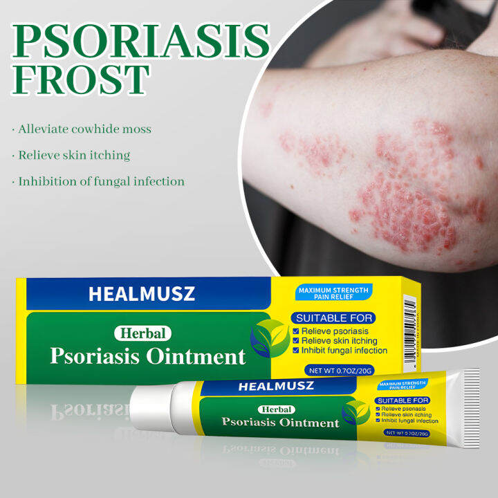 Idun Psoriasis Ointment Herb Eczema Treatment Cream Fast Effective