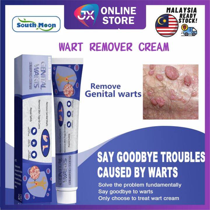 South Moon Wart Remover 克疣膏 鸡眼膏 疣膏 除疣膏 克疣 鸡眼 ketuat remover skin tags