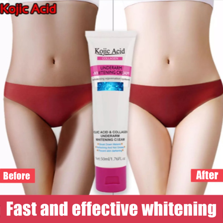 Kojic Acid Collagen Body Creams Armpit Whitening Cream Between Legs Knees Private Parts 3652