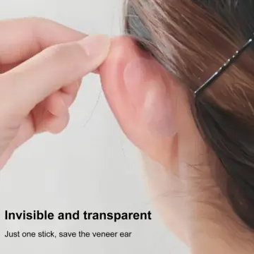 Elf Ear Stickers Veneer Ears Become Ear Correction Ear Vertical