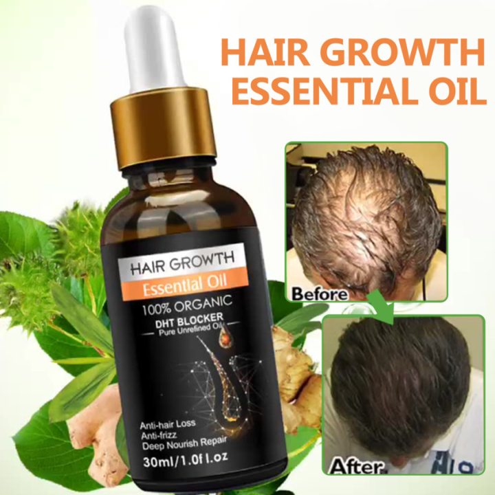 Hair Growth Essential Oil Biotin Cold-Pressed DHT Blocker And Hair ...