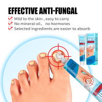 ครีมกำจัดเชื้อราเล็บ Onychomycosis,ครีมรักษาเล็บเชื้อราที่เล็บป้องกันการติดตั้งเท้าครีมดูแลเล็บเชื้อรา1ชิ้น