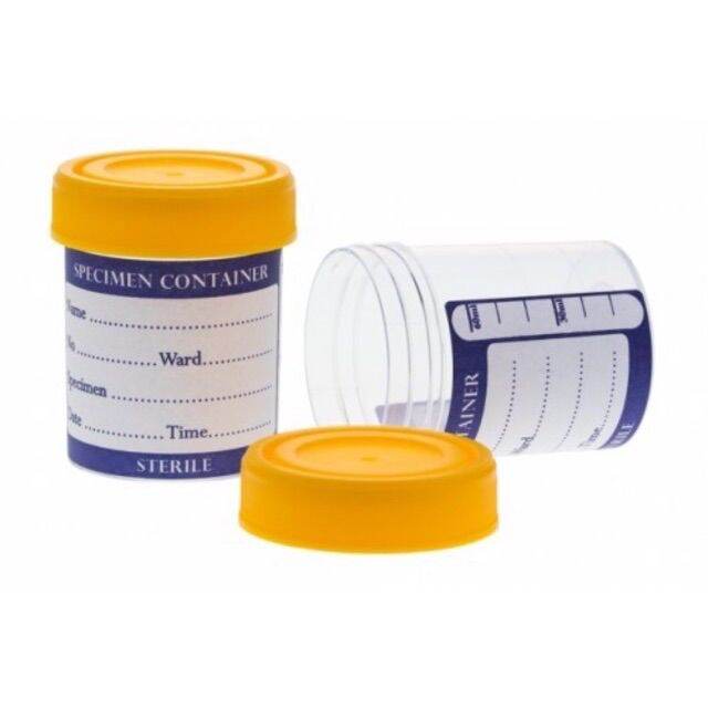 urine specimen bottle 60ml Lazada