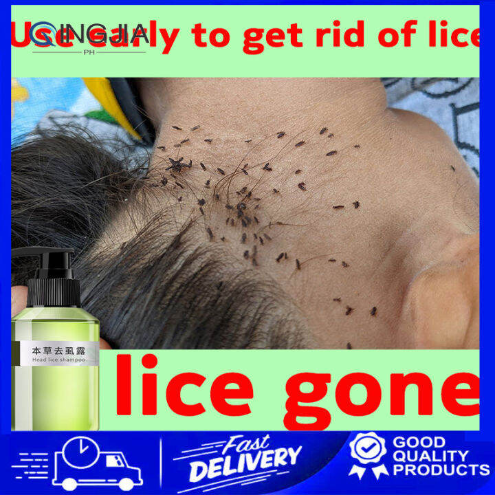 lice removal shampoo 100ml Free shower cap grate comb kuto and lisa remover shampoo  lice remover | Shopee Philippines