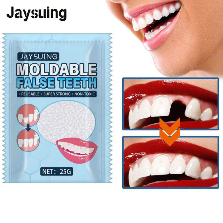 Jaysueing resin dentures for dental restorations Permanent fillers