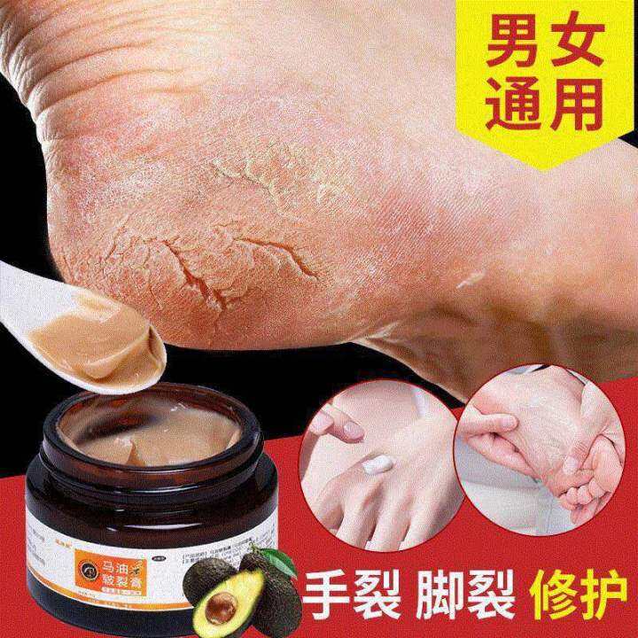 HORSE OIL HANDS AND FEET REPAIR Penghalus kulit kaki, tangan tumit ...