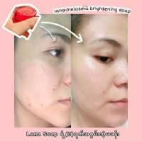 LANA MELASMA BRIGHTENING SOAP