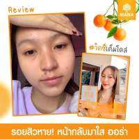 *ส่งทุกวัน*1แถม1 390ส่งฟรี ไม่ต้องใช้โค้ด* Mana vit-c มานาวิตซี วิตามินซีเสริมภูมิ ต้านหวัด ช่วยให้ผิวใส วิตามินซีเข้มข้น ดูดซึมไว 1ช้อน 5,000mg