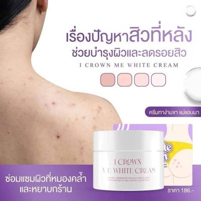 ครีมแม่แอนนา ครีมทารักแร้ดำ ขาหนีบดำ ข้อศอกดำ ครีมบำรุงผิว I Crown Me white cream