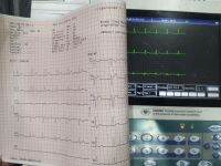 กระดาษปริ้นท์ EKG/ECG ขนาด 210mm. ยาว 25เมตร [1 pack = 1 ม้วน] สินค้าพร้อมส่ง