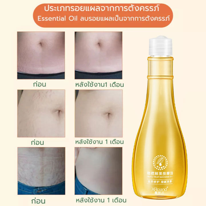 xroland-ครีมลดรอยแตก-150g-ขาแตกลาย-ลดรอยแตกลาย-กระชับผิวให้เรียบเนียน-เพิ่มความชุ่มชื้นให้แก่ผิว-ครีมทารอยแตกขา-ครีมรอยเเตกลาย-ครีมทาท้องลาย-ครีมทารอยแตก-ครีมทาหลังคลอด-ครีมกันแตกลาย-ครีมแก้แตกลาย-ครี