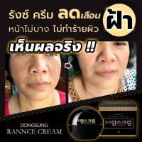 ครีมลดฝ้า ตัวดังจากเกาหลี?? DONGSUNG RANNCE CREAM ขนาดทดลอง 10 กรัม