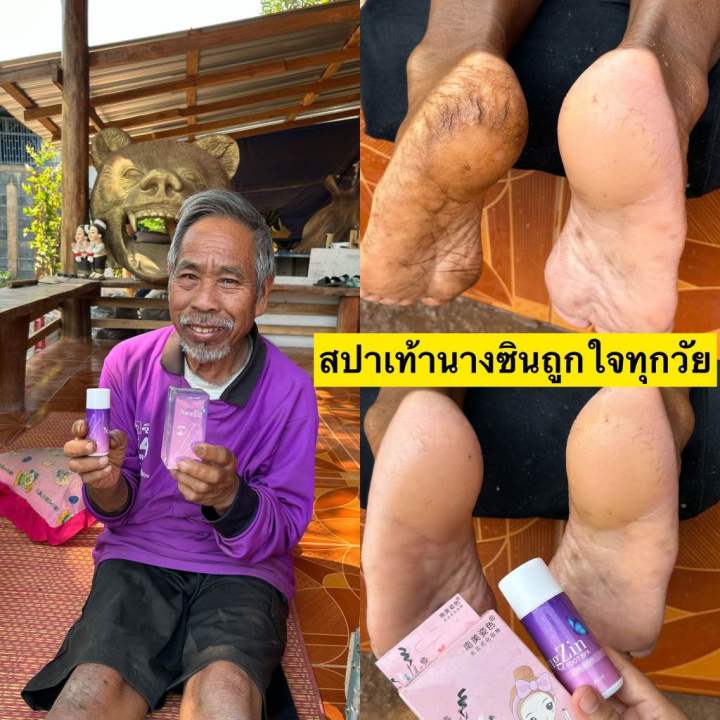 nangzin-foot-spa-สปาเท้านางซิน-นางซินสปาเท้า-สปาเท้าแตก-ส้นเท้าแตก-ลดกลิ่นเท้าเหม็น-ตาตุ่มดำด้าน-ไม่แสบ
