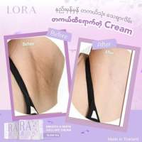 Lora Cream