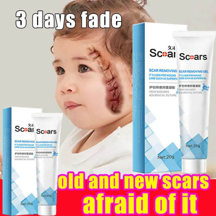 EFFECTIVE Magic Scar Remover Gel Scar Remover Skin Repair Remove Stretch Marks Cream,Scar