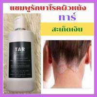 ?Tar Shampoo ทาร์แชมพู แชมพูสำหรับโรคผิวหนัง? แชมพูน้ำมันดิน โรคสะเก็ดเงิน เชื้อรา เซบเดิร์ม อาการคัน รังแค (120 มล.) ทาร์แชมพู