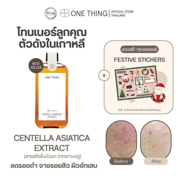 โทนเนอร์ลูกคุณตัวดัง-centella-asiatica-extract-จางรอยสิว-ลดผิวอักเสบ-exp-2026-สำหรับทุกสภาพผิว