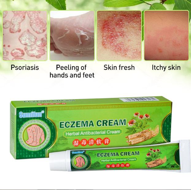 👍 100% ORIGINAL & Effective Eczema Treatment herbal antibacterial cream ...