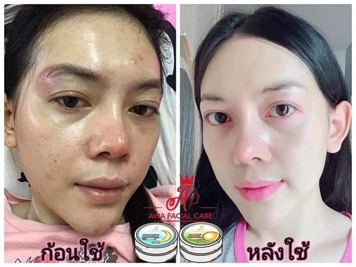 เนื้อแท้ดังเดิมเจ้าของแบรนด์คนเดิม-เอวาครีม-มาในชื่อใหม่แท้100-สูตรหน้าใส-สกัดจากผงไขมุก-ชาเขียว-และ-วิตตามินe-ช่วยให้ผิวหน้าเรียบเนียน-ขาวกระจ่างใส-วิธีใช้-ทาเช้า-ก่อนนอน-สูตรลดสิวบำรุงก่อนอน-เขียว-ส