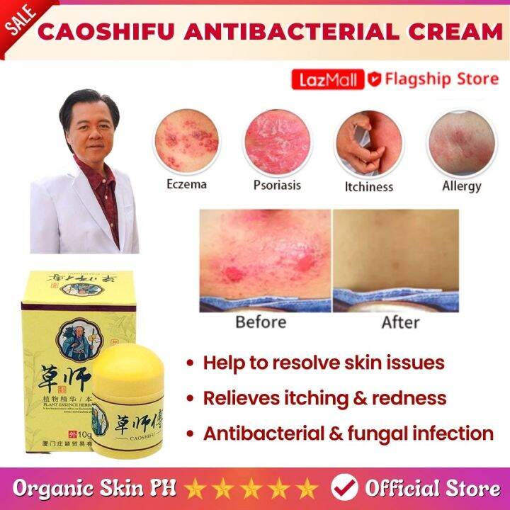 Caoshifu Ointment Cream Herbal Treatment Cure For Itchy Skin Allergy Like Eczema Psoriasis 2296