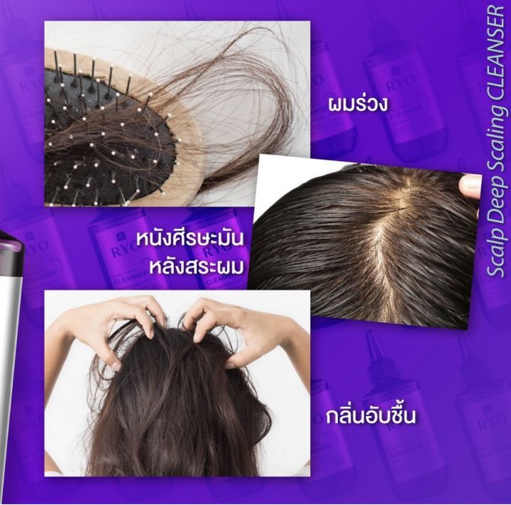 ผลิตภัณฑ์ลดผมร่วงจากเกาหลี-ryo-anti-hair-loss-essence-80ml-เซรั่มบำรุงรากผม-ลดผมร่วง