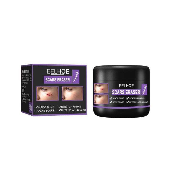 Jaysuing Effective Scar Eraser Scar Removal Cream Acne Stretch Marks