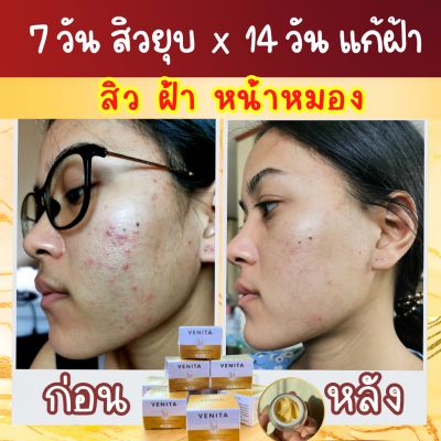 10g ครีมโสมสกุล ครีม โสม ครีมลดสิว ครีมลดฝ้า ครีมหน้าใส ครีมรักษาสิว ปลอดภัย ไร้สารอันตราย