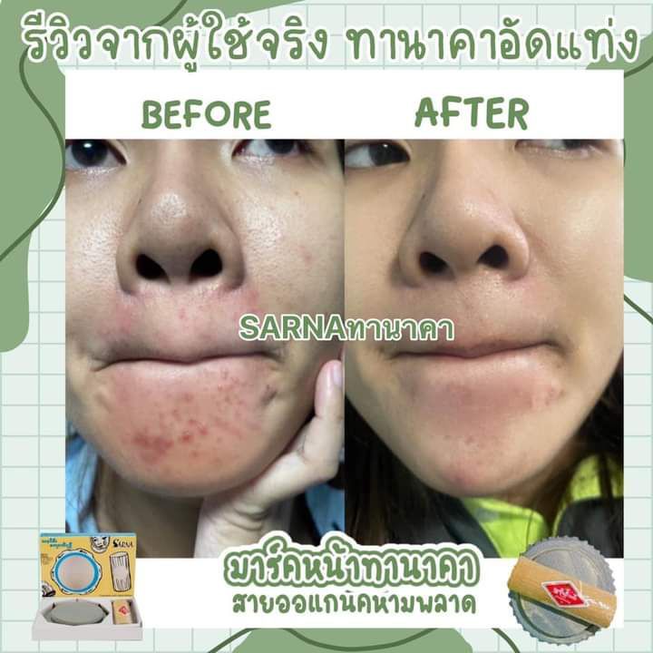 ส่งฟรี-แถมฟรีแปรงมาร์ก-ทานาคา-ทานาคาพร้อมหินฝน-ทานาคาแท้นำเข้าจากพม่า