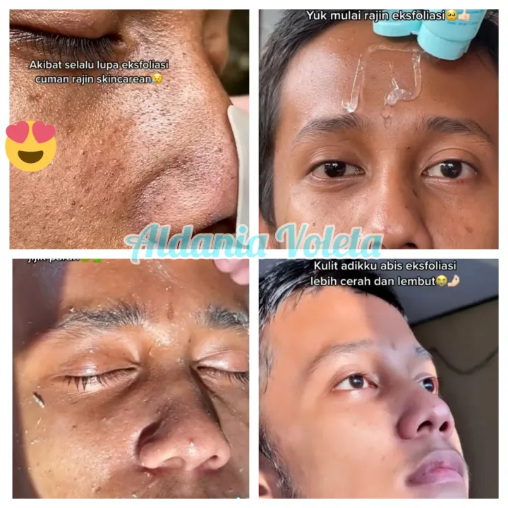 Cleora Exfoliating Gel Eksfoliasi Terbaik Lazada Indonesia