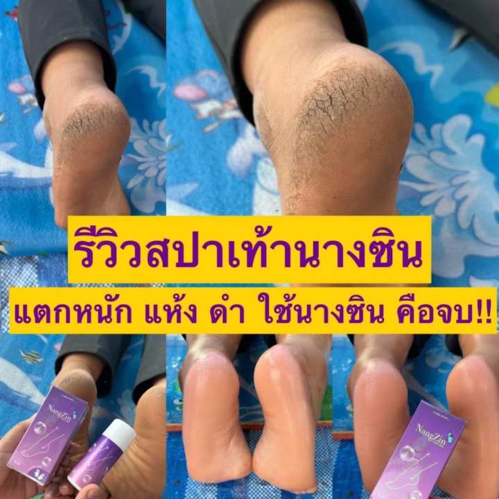 nangzin-foot-spa-สปาเท้านางซิน-นางซินสปาเท้า-สปาเท้าแตก-ส้นเท้าแตก-ลดกลิ่นเท้าเหม็น-ตาตุ่มดำด้าน-ไม่แสบ