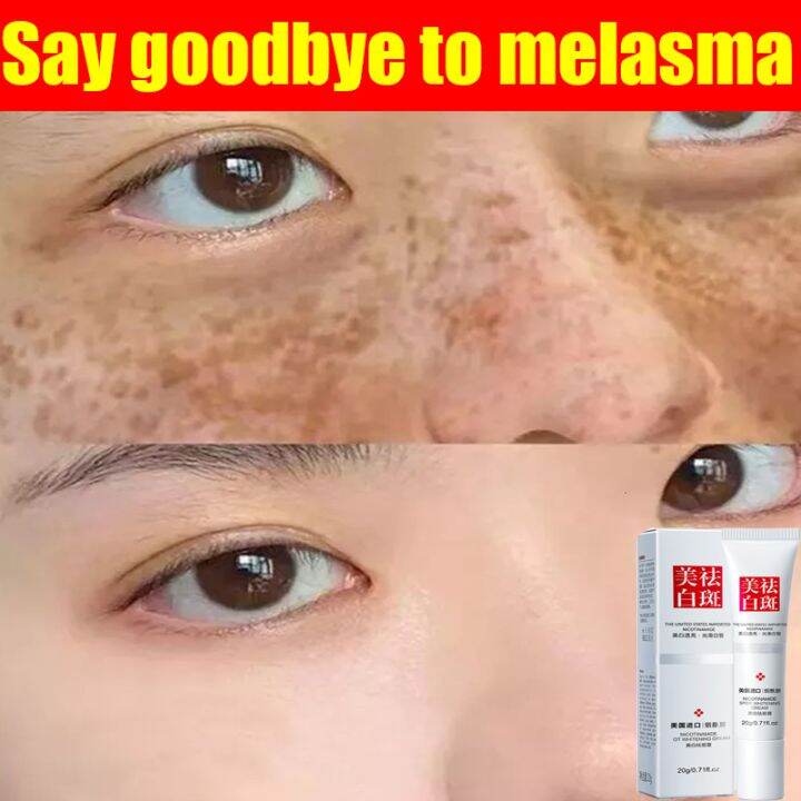 Retinol Serum For Face Serum Vitamin c & Collagen Effective Freckle