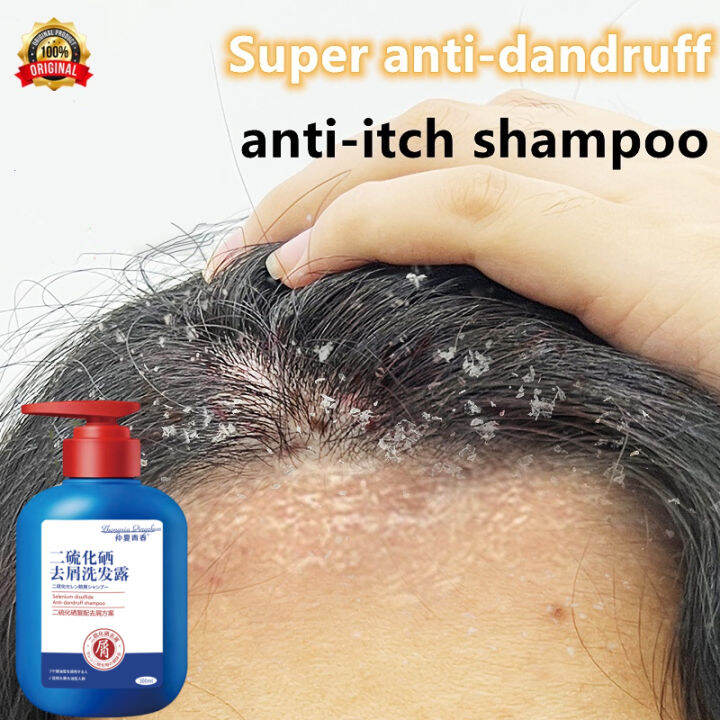 Shampoo kelemumur anti dandruff itchy scalp oil control remove mite ...