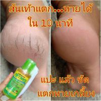 น้ำยาสมุนไพรขัดส้นเท้าแตก สปาเท้าแตกสุภาพร 60ml.ฟรี‼️ถุงมือ สำลี โฟมขัด