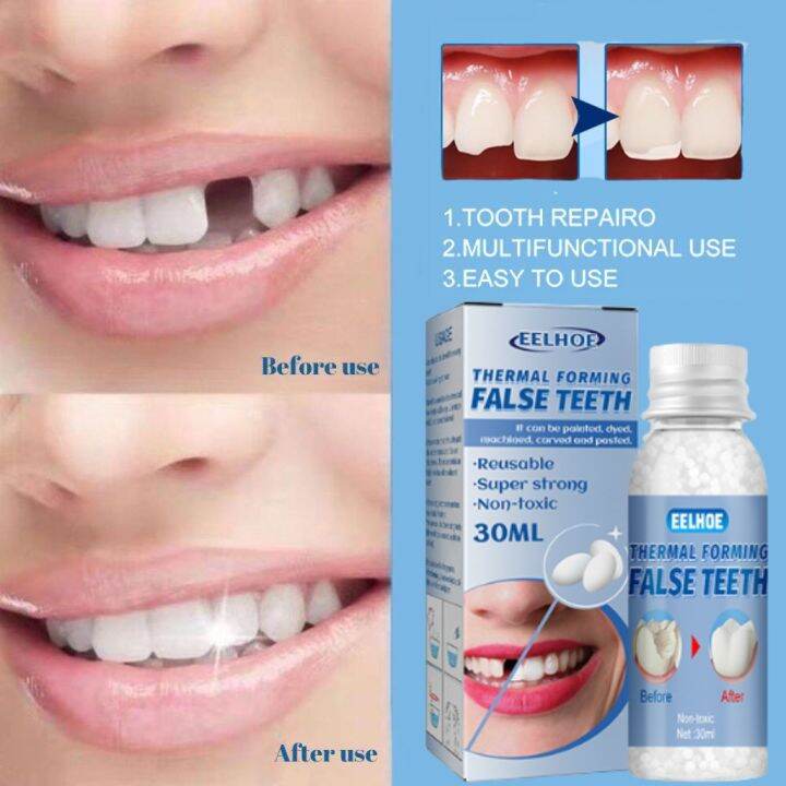 🔥attraction🔥denture Filling Solid Gel Moldable Dental Glue Makeup