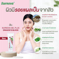 Burnova gel plus dragons blood ขนาด 20 กรัม บำรุงผิว ลดจุดด่างดำ