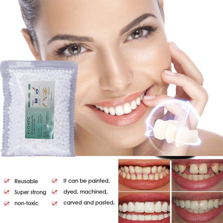 【Fast filling】DIY Temporary Tooth Repair kit Artificial temporary tooth