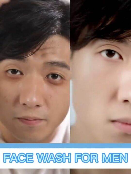 Facial Wash for Men Whitening Anti Pimples Pore Minimizer Eliminate