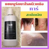 ?Tar Shampoo ทาร์แชมพู แชมพูสำหรับโรคผิวหนัง? แชมพูน้ำมันดิน สำหรับโรคสะเก็ดเงิน เชื้อรา เซบเดิร์ม อาการคัน รังแค (120 มล.) แชมพูทาร์ ศิริราช