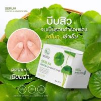 PONTINA BY PONTIP เซรั่มใบบัวบก?ปลอบประโลมทุกปัญหาผิว และยังช่วยให้สิวอักเสบยุบไว แถมช่วยให้ผิวชุ่มชื่นตลอดวัน รับรองปังแน่