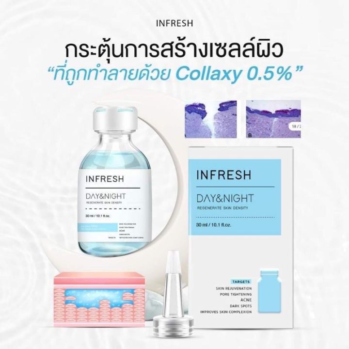 พร้อมส่งจ้า-ของแท้-infresh-เซรั่มรักษาหลุมสิวสูตรเร่งรัด-หายขาดถาวร