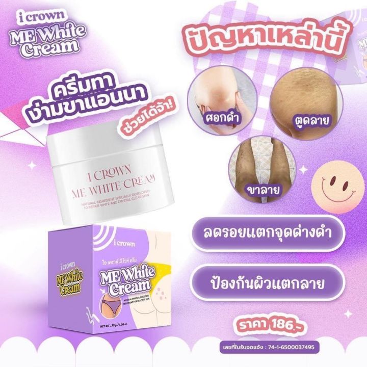 me-white-cream-ครีมทาง่ามขาแอนนา-ครีมแม่แอนนา-30-g