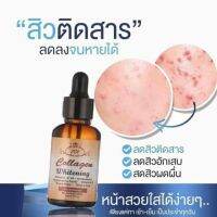 เซรั่มคอลลาเจน มาเล แท้100%สิว ฝ้า กระลึก เคยใช้สารพัดครีมก็ไม่หาย  เซรั่มหน้าใสไร้สิวและริ้วรอย ขวดเดียวรับรองหน้าเป๊ะเวอร์  เห็นความเปลี่ยนแปลงใน 1 ขวด ‼️‼️