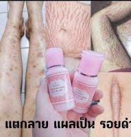 เซร่มลบรอยแตกลาย ท้องลาย แผลเป็น แตกลายหลังคลอด ขวดใหญ่ 30ml.