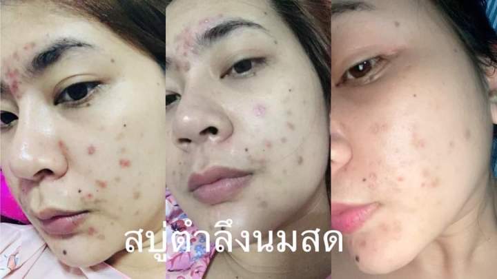 สบู่ตำลึง-สบู่พุ่มบุตร-ของแท้พร้อมส่ง