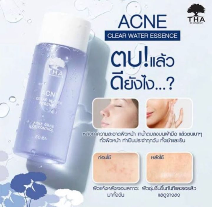 tha-acne-clear-water-essence-ฑาบายน้องฉัตร-น้ำตบน้องฉัตร-น้ำตบเอสเซนต์